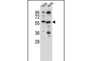 CSAD Antibody (Center) (ABIN655728 and ABIN2845175) western blot analysis in CEM,A549 cell line lysates (35 μg/lane). (CSAD Antikörper  (AA 197-226))
