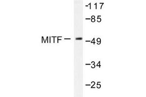 Image no. 1 for anti-Microphthalmia-Associated Transcription Factor (MITF) antibody (ABIN272035) (MITF Antikörper)
