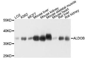 Western blot analysis of extracts of various cell lines, using ALDOB antibody. (ALDOB Antikörper  (AA 1-200))