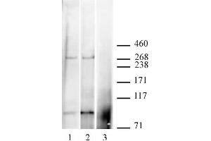 CABIN1 antibody (pAb) tested by Immunoprecipitation / Western blot. (CABIN1 Antikörper  (C-Term))