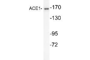 Western blot (WB) analysis of ACE1 antibody in extracts from mouse kidney cells. (Angiotensin I Converting Enzyme 1 Antikörper)