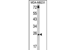 Western blot analysis of LTA Antibody (Center) (ABIN652448 and ABIN2842303) in MDA-M cell line lysates (35 μg/lane). (LTA Antikörper  (AA 46-72))