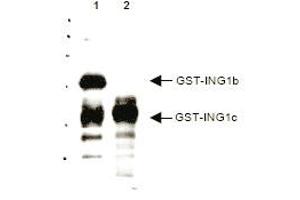 Western blot analysis using anti-p33 ING1 antibody to detect over expressed Human ING1 present in cell nuclear extracts. (ING1 Antikörper  (AA 285-296))