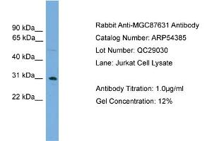WB Suggested Anti-MGC87631  Antibody Titration: 0. (MGC87631 (Middle Region) Antikörper)