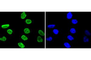 PC-3 cells were stained with MSK1 (Ser376) (11A1) Monoclonal Antibody  at [1:200] incubated overnight at 4C, followed by secondary antibody incubation, DAPI staining of the nuclei and detection. (MSK1 Antikörper  (pSer376))