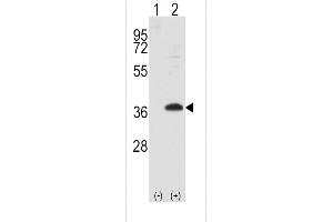 Western blot analysis of FRAT1 using rabbit polyclonal FRAT1 Antibody. (FRAT1 Antikörper  (AA 99-128))