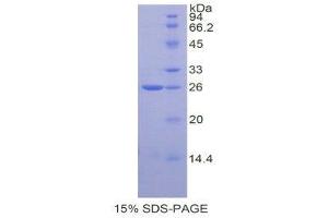 SDS-PAGE (SDS) image for TIMP Metallopeptidase Inhibitor 3 (TIMP3) (AA 27-209) protein (His tag) (ABIN1878287) (TIMP3 Protein (AA 27-209) (His tag))