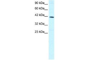 Human HepG2; WB Suggested Anti-FOXF2 Antibody Titration: 1. (FOXF2 Antikörper  (N-Term))