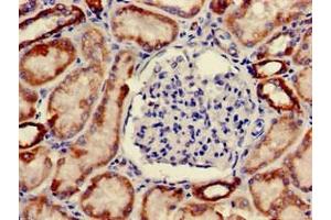 Immunohistochemistry of paraffin-embedded human kidney tissue using ABIN7162222 at dilution of 1:100 (ONECUT2 Antikörper  (AA 214-331))