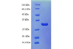 SDS-PAGE (SDS) image for Kallikrein B, Plasma (Fletcher Factor) 1 (KLKB1) (AA 391-638), (Light Chain) protein (His tag) (ABIN5709815)