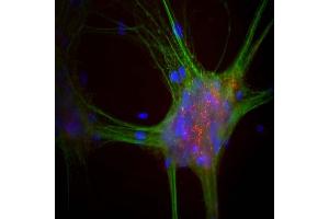 Mixed neuron-glial cultures stained with ABIN1842241, our monoclonal antibody to α-synuclein (red) and chicken polyclonal antibody to MAP2 CPCA-MAP2 (green). (SNCA Antikörper)