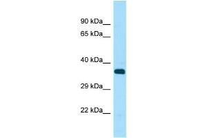 Western Blotting (WB) image for anti-serine/threonine Kinase 33 (STK33) (C-Term) antibody (ABIN2506070) (STK33 Antikörper  (C-Term))