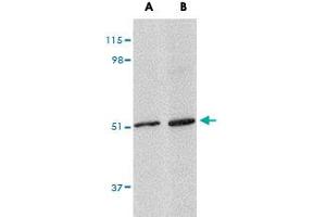 Western blot analysis of LASS5 in SK-N-SH cell lysate with LASS5 polyclonal antibody  at (A) 1 and (B) 2 ug/mL . (LASS5 Antikörper  (N-Term))