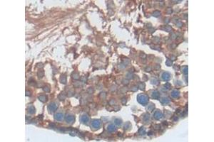 IHC-P analysis of Kidney tissue, with DAB staining. (S100A16 Antikörper  (AA 1-97))