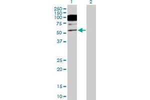 Western Blot analysis of CACNB1 expression in transfected 293T cell line by CACNB1 MaxPab polyclonal antibody.