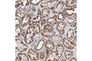 Immunohistochemical staining of human kidney with SPATA5 polyclonal antibody  shows strong cytoplasmic positivity in renal tubules. (SPATA5 Antikörper)