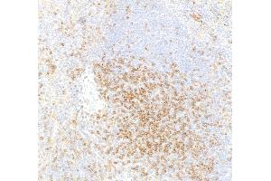 Immunohistochemistry (IHC) image for anti-CD4 (CD4) (AA 407-457) antibody (ABIN7453902) (Rekombinanter CD4 Antikörper  (AA 407-457))
