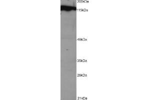 Western Blotting (WB) image for Damage Specific DNA Binding Protein 1 (DDB1) peptide (ABIN368888) (Damage Specific DNA Binding Protein 1 (DDB1) Peptid)