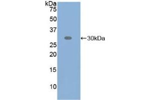 Western blot analysis of recombinant Human ATF6. (ATF6 Antikörper  (AA 423-646))