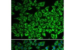 Immunofluorescence analysis of A549 cells using IL12RB1 Polyclonal Antibody (IL12RB1 Antikörper)