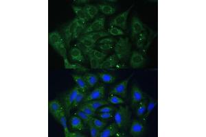 Immunofluorescence analysis of U-2 OS cells using IGF2BP2/IMP2 antibody (ABIN6131799, ABIN6142242, ABIN6142244 and ABIN6218878) at dilution of 1:100. (IGF2BP2 Antikörper  (AA 330-599))