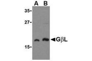 Western blot analysis of GbL in human brain cell lysate with AP30359PU-N GbL antibody at (A) 1 and (B) 2 μg/ml.