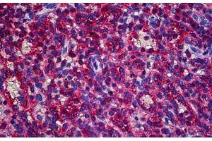 Human Spleen: Formalin-Fixed, Paraffin-Embedded (FFPE) (CAPZB Antikörper  (AA 192-272))