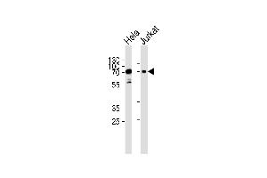 Western blot analysis of lysates from Hela, Jurkat cell line (from left to right), using Mouse Pak3 Antibody (N-term) (ABIN657852 and ABIN2846813). (PAK3 Antikörper  (N-Term))