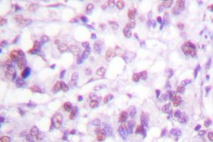 Image no. 1 for anti-V-Myb Myeloblastosis Viral Oncogene Homolog (Avian) (MYB) antibody (ABIN272041) (MYB Antikörper)