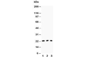 Western blot testing of TNFb antibody and Lane 1:  HeLa (LTA Antikörper  (AA 45-59))
