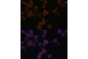 Immunofluorescence analysis of NIH-3T3 cells using AMPKβ1 Polyclonal Antibody (ABIN6129906, ABIN6146174, ABIN6146176 and ABIN7101403) at dilution of 1:100 (40x lens). (PRKAB1 Antikörper  (AA 1-80))
