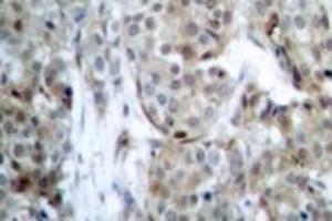 Image no. 2 for anti-BCL2-Associated Agonist of Cell Death (BAD) (pSer112), (pSer75) antibody (ABIN318169) (BAD Antikörper  (pSer75, pSer112))