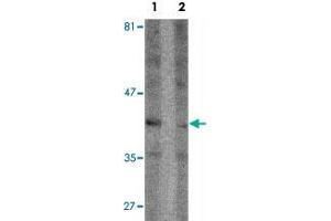 Western blot analysis of Raji cell lysate with SEPT1 polyclonal antibody  at 1 ug/mL in (1) the absence and (2) the presence of blocking peptide. (Septin 1 Antikörper  (C-Term))