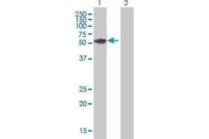 Western Blot analysis of ZNF276 expression in transfected 293T cell line by ZNF276 MaxPab polyclonal antibody. (ZNF276 Antikörper  (AA 1-373))