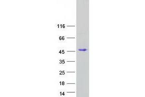 Western Blotting (WB) image for ELL Associated Factor 2 (EAF2) protein (Myc-DYKDDDDK Tag) (ABIN2719899)