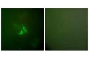 Immunofluorescence analysis of A549 cells, using Cox2 antibody. (PTGS2 Antikörper)