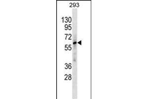 ZNF775 Antikörper  (C-Term)