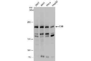 WB Image CSB antibody detects CSB protein by western blot analysis.