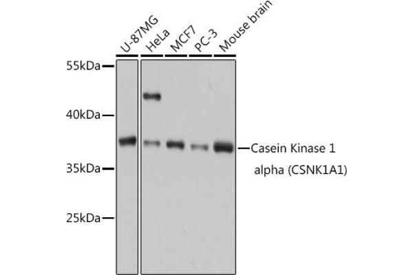 CSNK1A1 Antikörper  (AA 100-200)