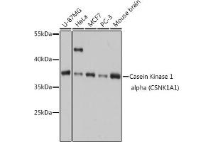 Western blot analysis of extracts of various cell lines, using Casein Kinase 1 alpha (Casein Kinase 1 alpha (CSNK1)) antibody (6225) at 1:1000 dilution. (CSNK1A1 Antikörper  (AA 100-200))