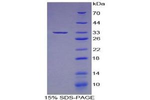 SDS-PAGE (SDS) image for Interferon Regulatory Factor 6 (IRF6) (AA 196-445) protein (His tag) (ABIN2125411)