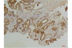 Immunohistochemistry (IHC) analysis of paraffin-embedded Human Prostate Tissue using Endothelin B Receptor Rabbit Polyclonal Antibody diluted at 1:200. (EDNRB Antikörper)