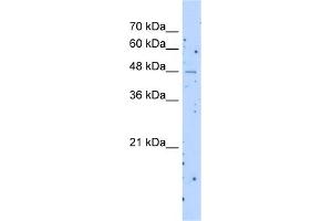 WB Suggested Anti-SLC22A23 Antibody Titration:  1. (SLC22A23 Antikörper  (Middle Region))