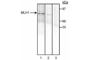 Immunoprecipitation of MLH1.