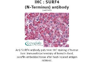 Image no. 1 for anti-Surfeit 4 (SURF4) (N-Term) antibody (ABIN1739778)