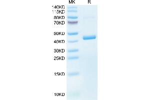 Mouse CXCL4 on Tris-Bis PAGE under reduced condition. (PF4 Protein (AA 30-105) (Fc Tag))