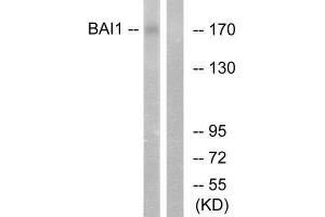 Western Blotting (WB) image for anti-Brain-Specific Angiogenesis Inhibitor 1 (BAI1) (Internal Region) antibody (ABIN5978285) (BAI1 Antikörper  (Internal Region))