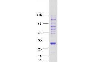 Western Blotting (WB) image for Von Hippel-Lindau Tumor Suppressor, E3 Ubiquitin Protein Ligase (VHL) (Transcript Variant 1) protein (Myc-DYKDDDDK Tag) (ABIN2735257)