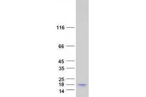 Validation with Western Blot (MYL9 Protein (Transcript Variant 2) (Myc-DYKDDDDK Tag))