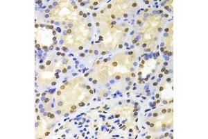 Immunohistochemistry of paraffin-embedded human kidney using HDGF Antibody (ABIN1876535) at dilution of 1:100 (40x lens). (HDGF Antikörper)